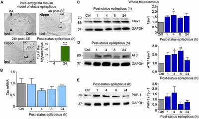 Tau Phosphorylation in a Mouse Model of Temporal Lobe Epilepsy